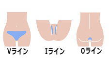 VIOライン文字入り